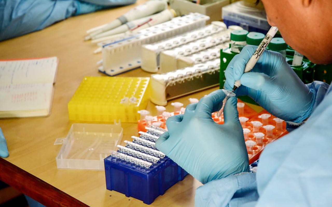 coronavirus covid 19