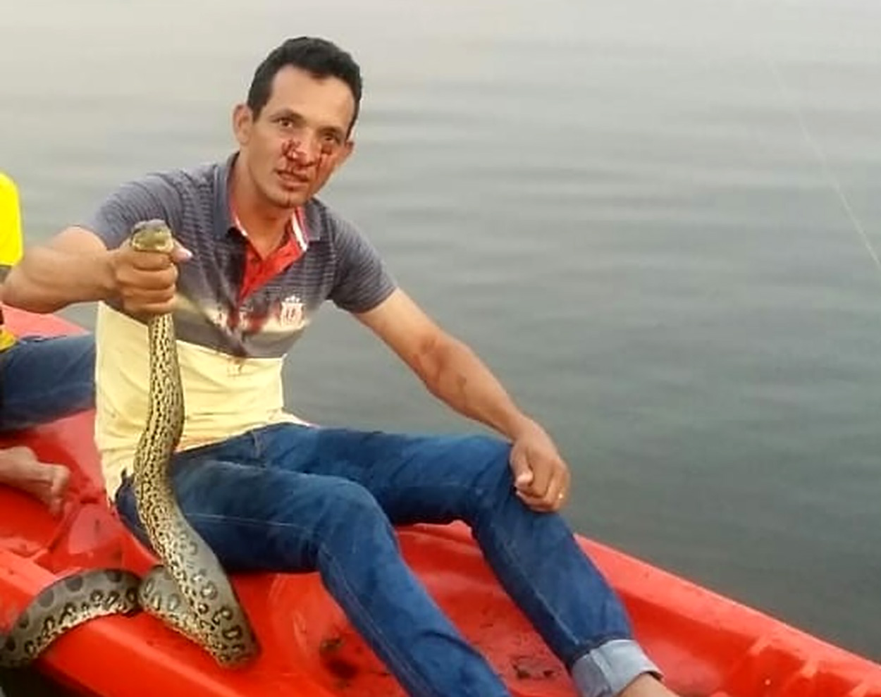 Moises rodrigues atacado por sucuri