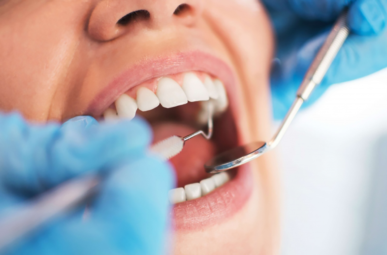 dentista tratamento odotologico dente 
